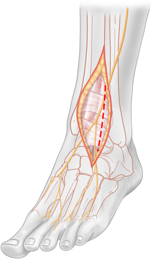 Foot