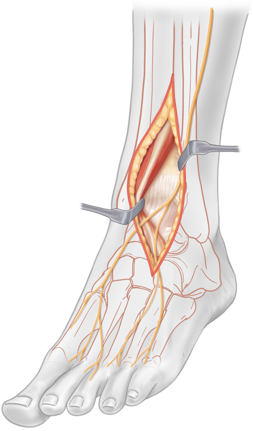 Foot