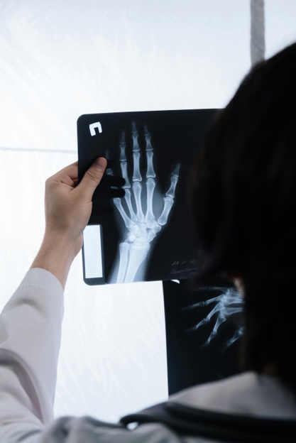 A person looking at x-ray of a hand

Description automatically generated