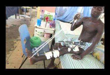 How to Better Treat Trauma Injuries in the Developing World