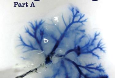Promoting endochondral bone repair using osteoarthritic human articular chondrocytes