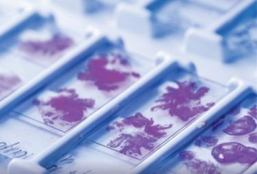 Journal of Tissue Engineering and Regenerative Medicine (Accepted)